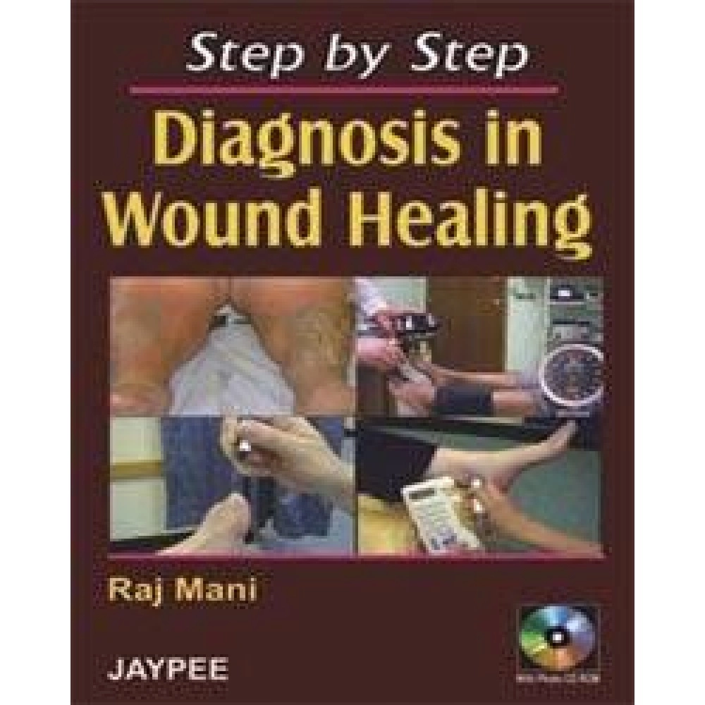 Step by Step Diagnosis in Wound Healing with Photo CD-ROM
