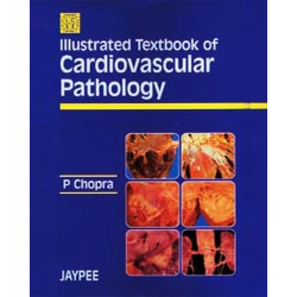 Illustrated Textbook of Cardiovascular Pathology