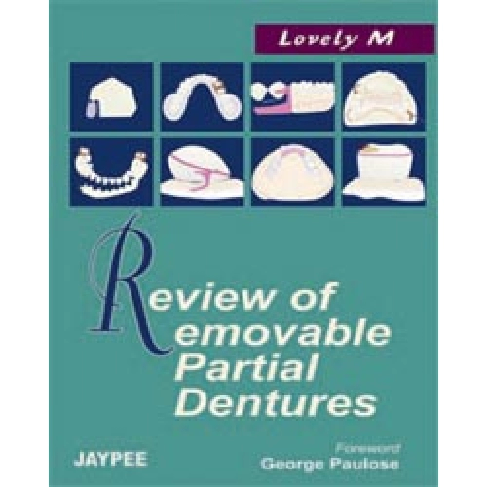 Review Of Removable Partial Dentures
