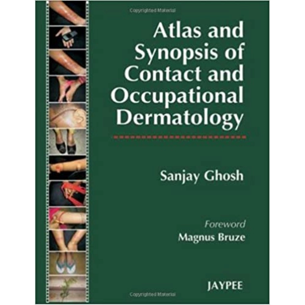 Atlas And Synopsis Of Contact And Occupational Dermatology
