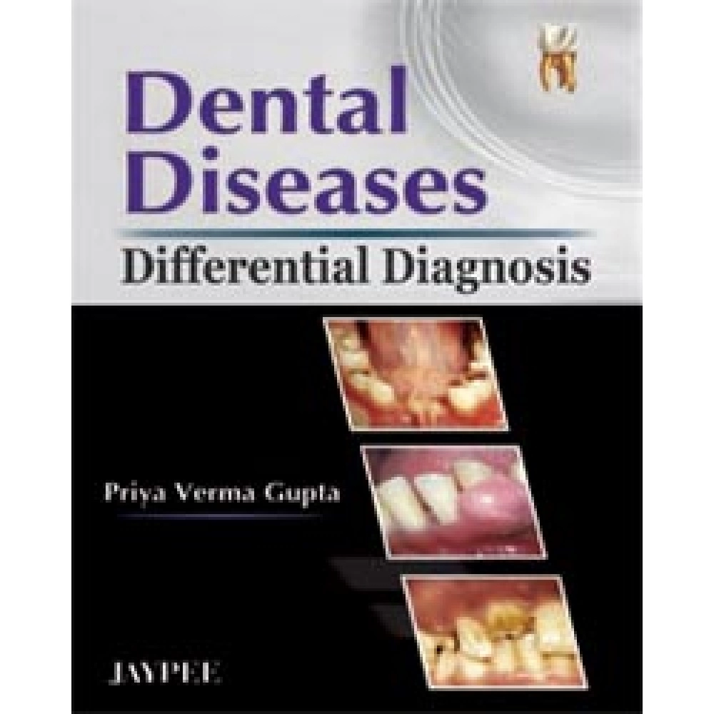 Dental Diseases Differential Diagnosis