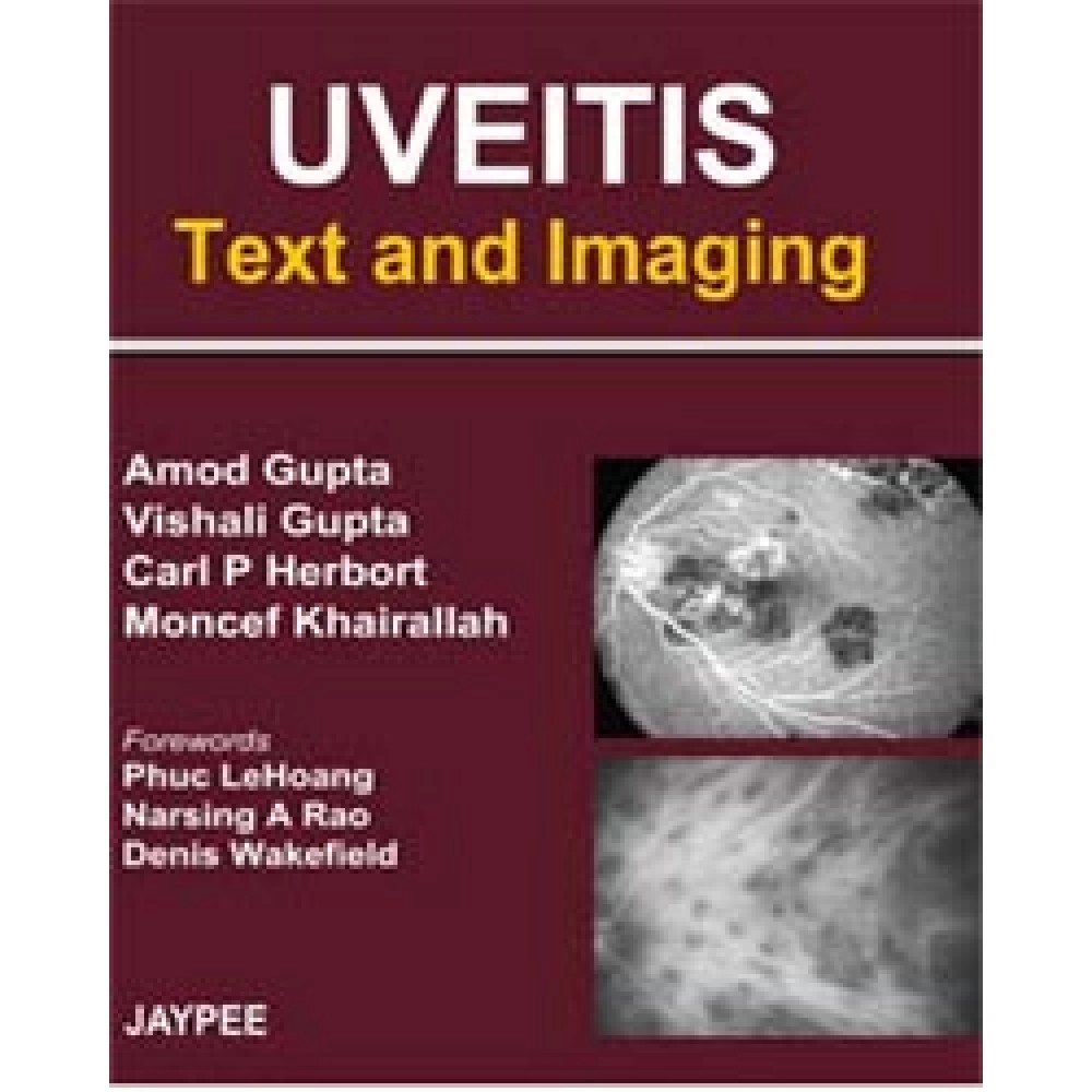 UVEITIS Text and Imaging