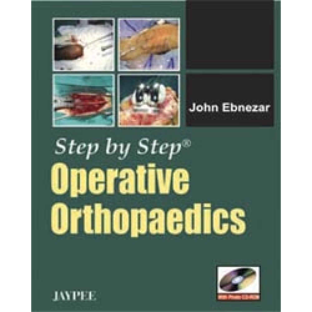 Step by Step Operative Orthopaedics with Photo CD-ROM