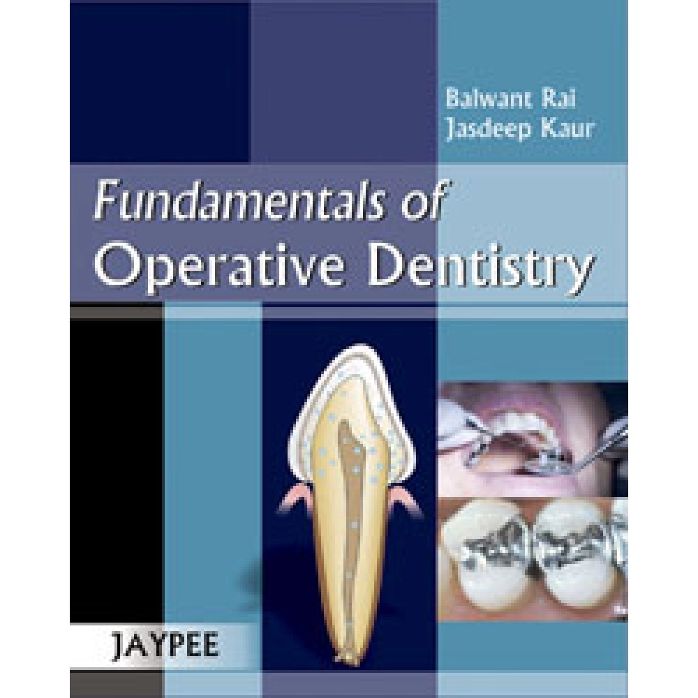 Fundamentals Of Operative Dentistry