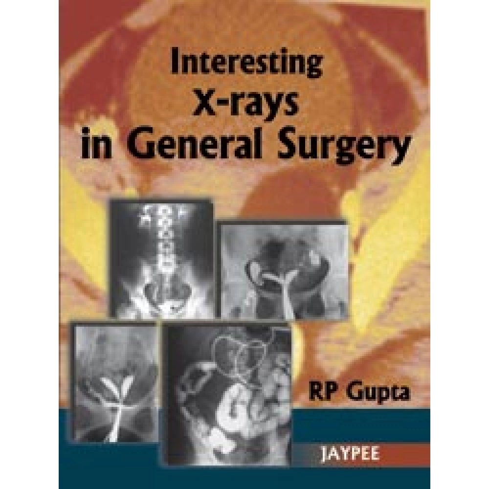 Interesting X-Rays In General Surgery