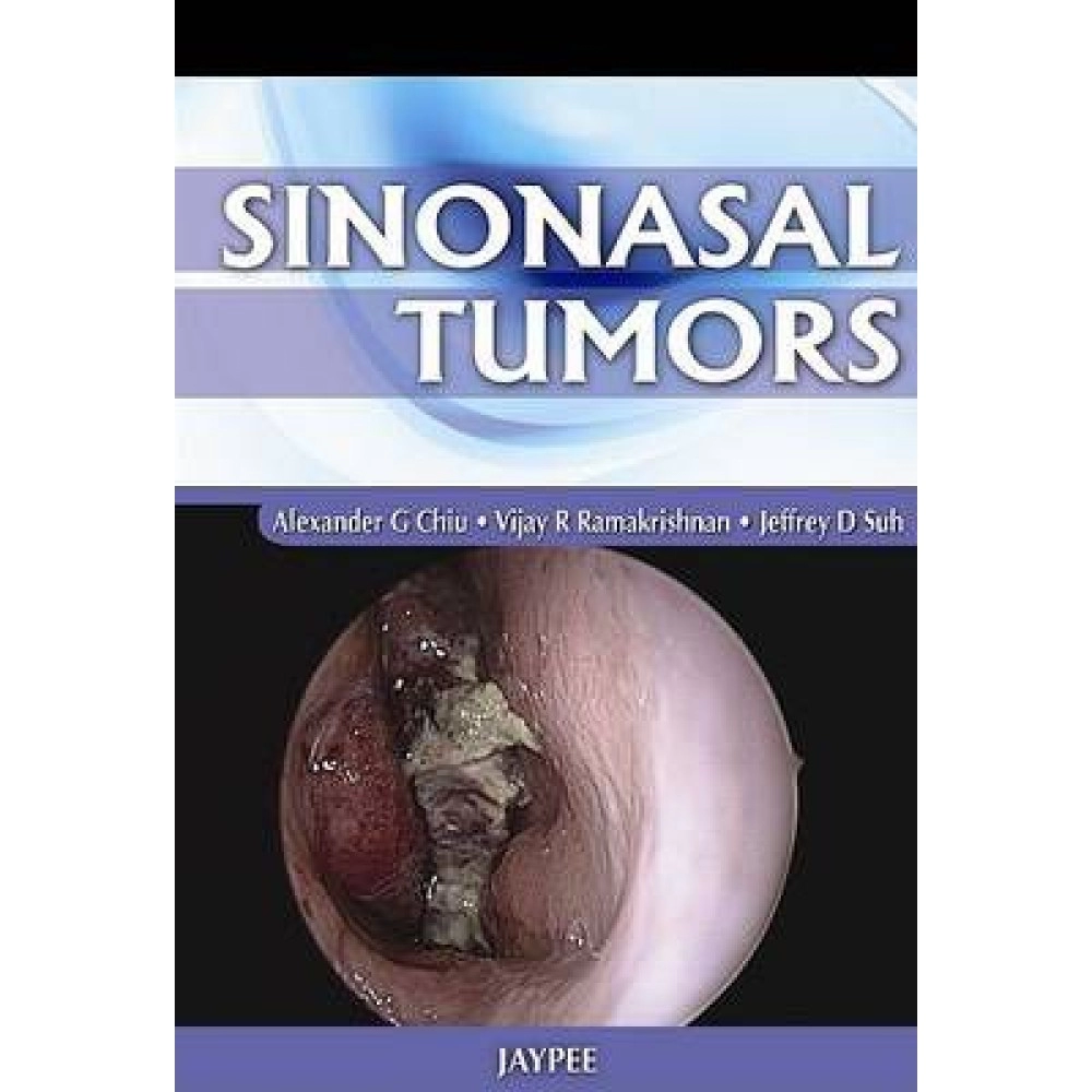 Sinonasal Tumors