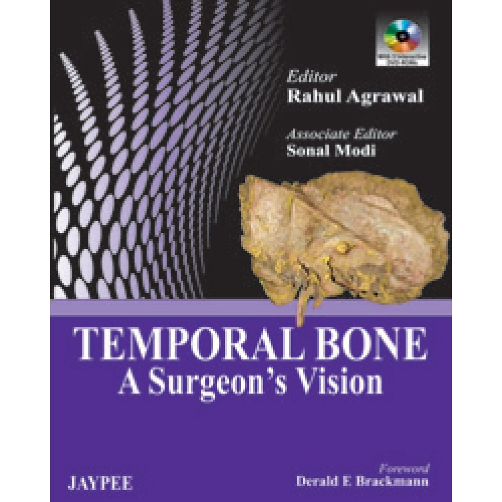 Temporal Bone: A Surgeon'S Vision With Dvd Rom
