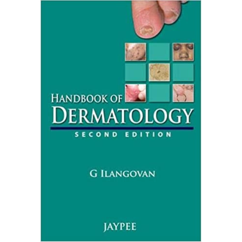 Handbook Of Dermatology