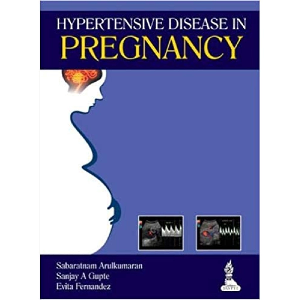 Hypertensive Disease In Pregnancy