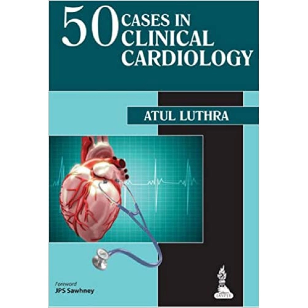 50 Cases in Clinical Cardiology