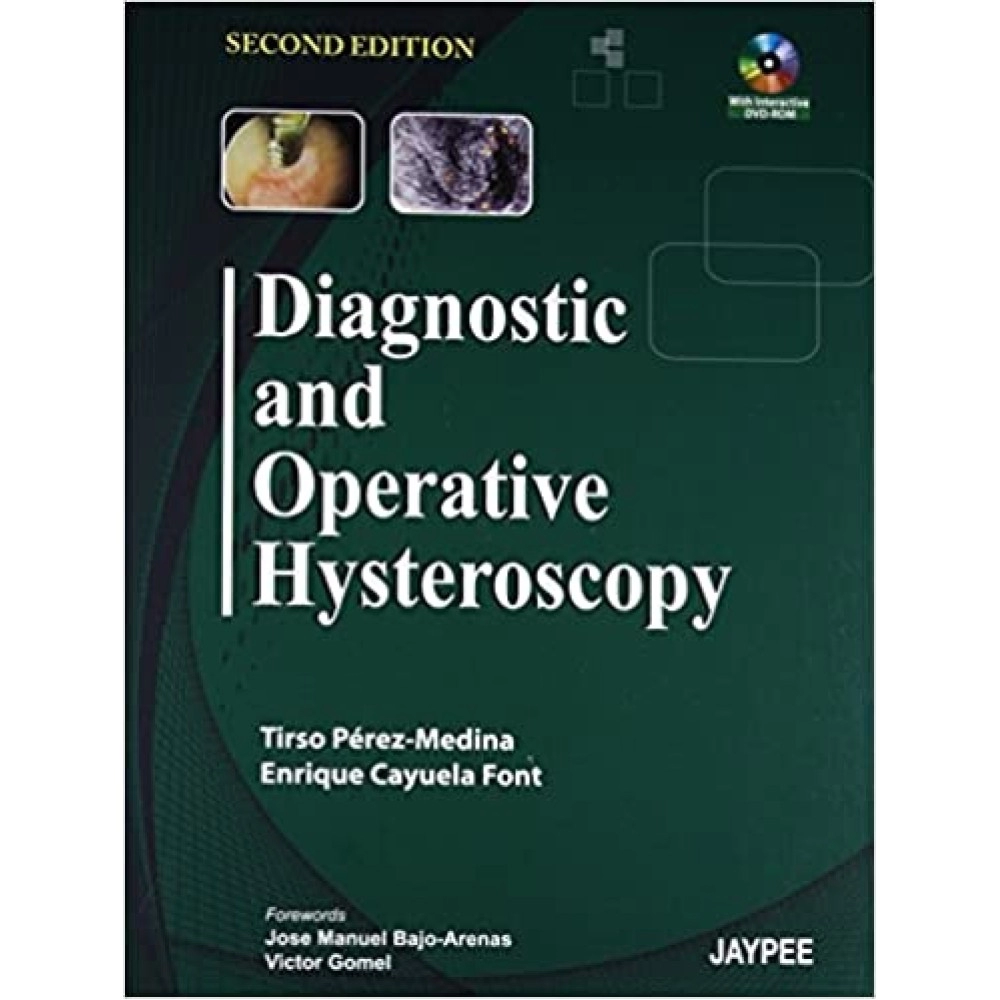 Diagnostic & Operative Hysteroscopy