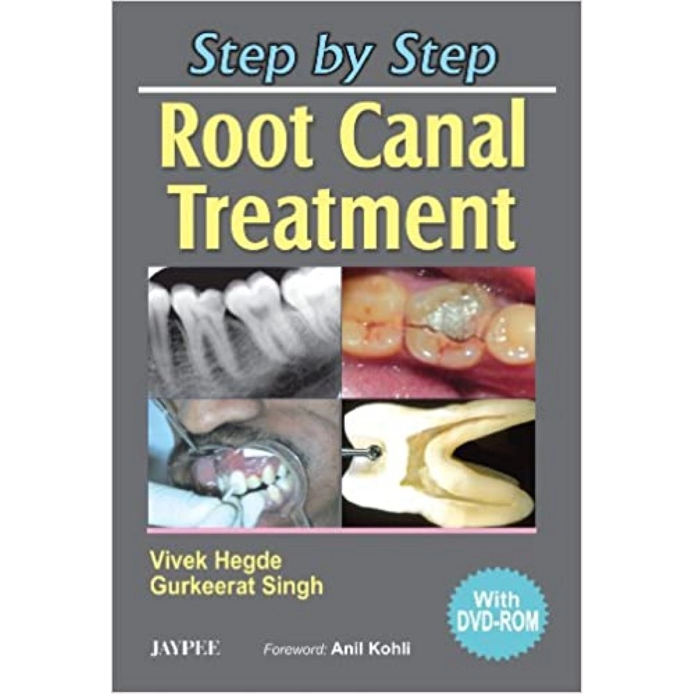 Step By Step Root Canal Treatment With Dvd Rom (E/2006)
