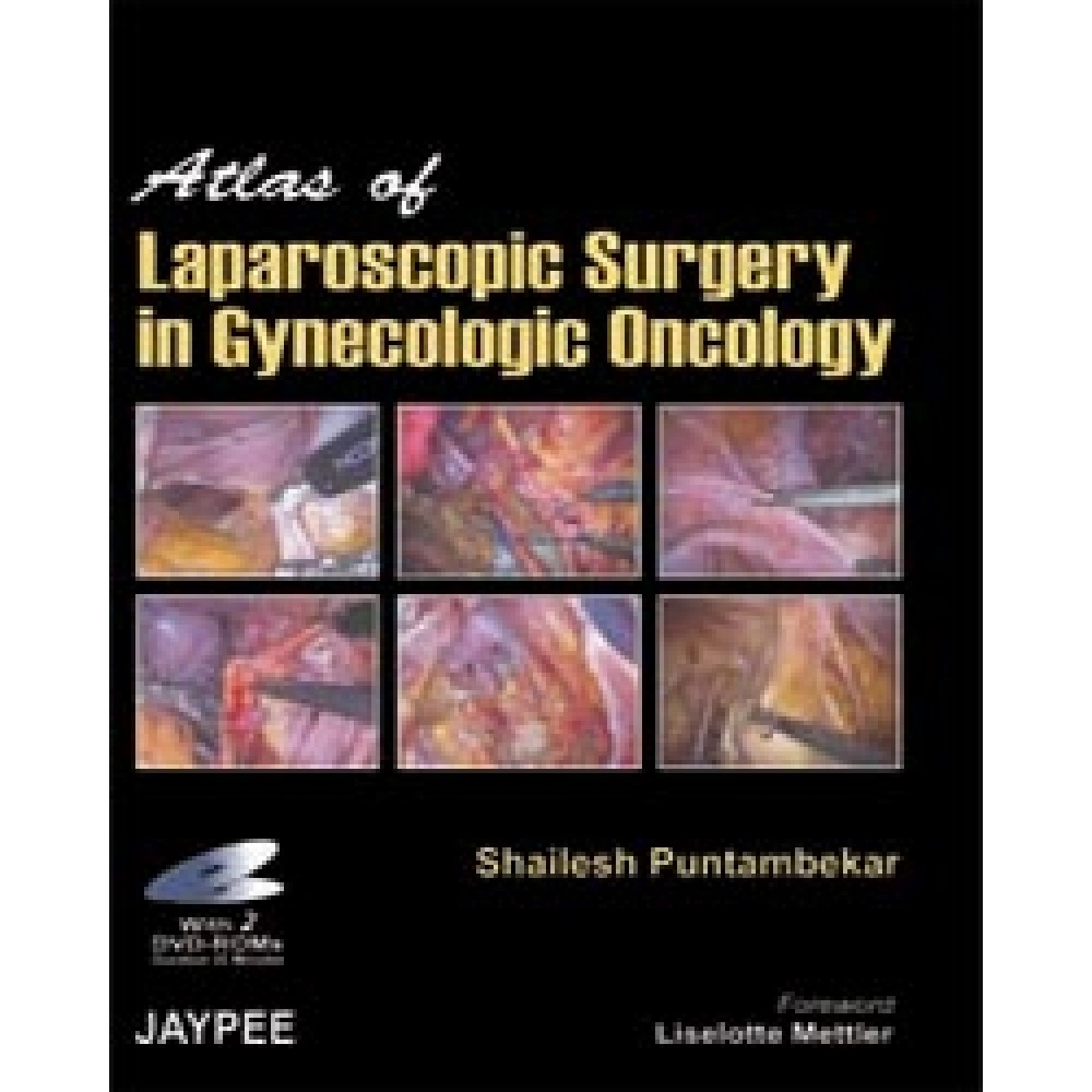 Atlas Of Laparoscopic Surgery In Gynecolog