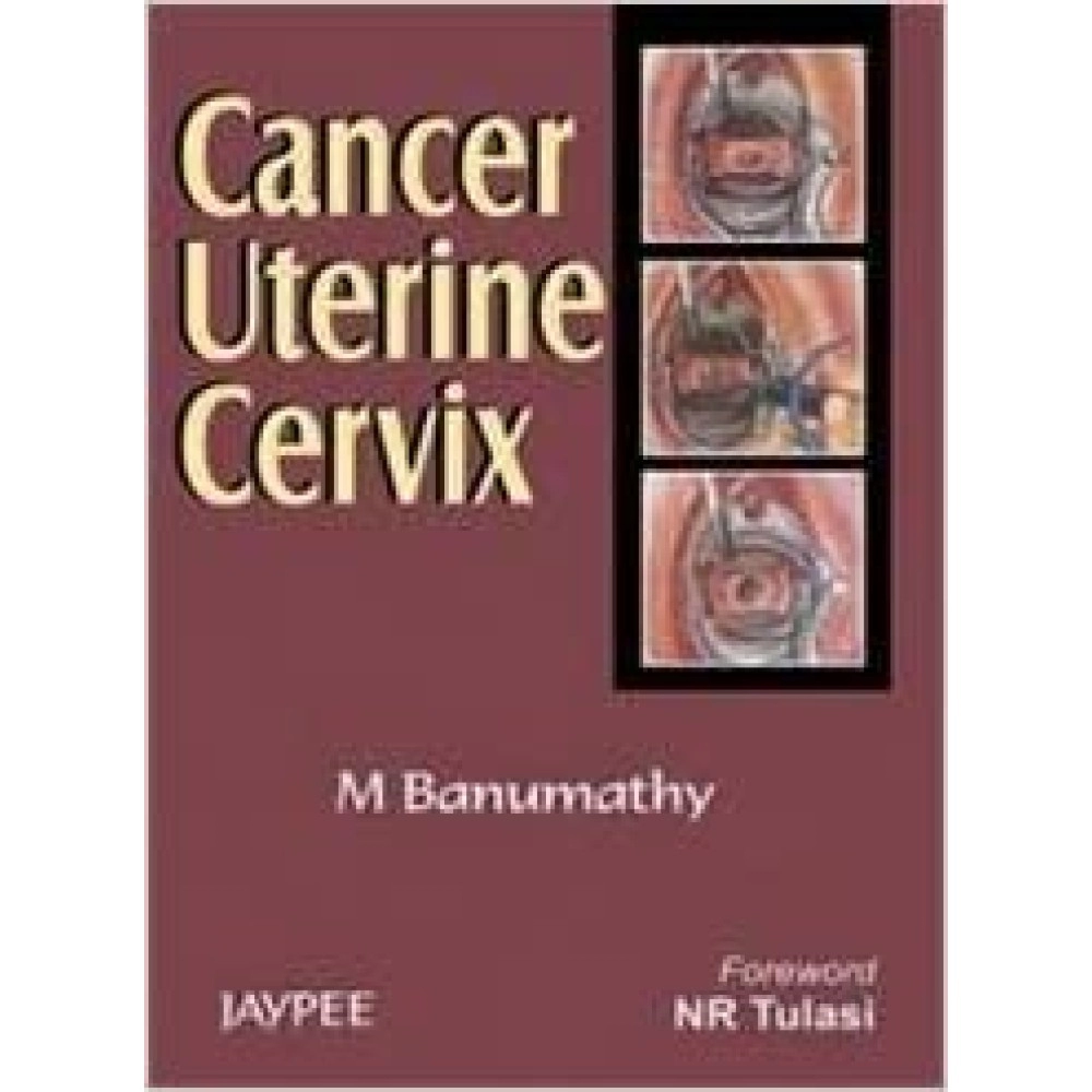 Cancer Uterine Cervix 