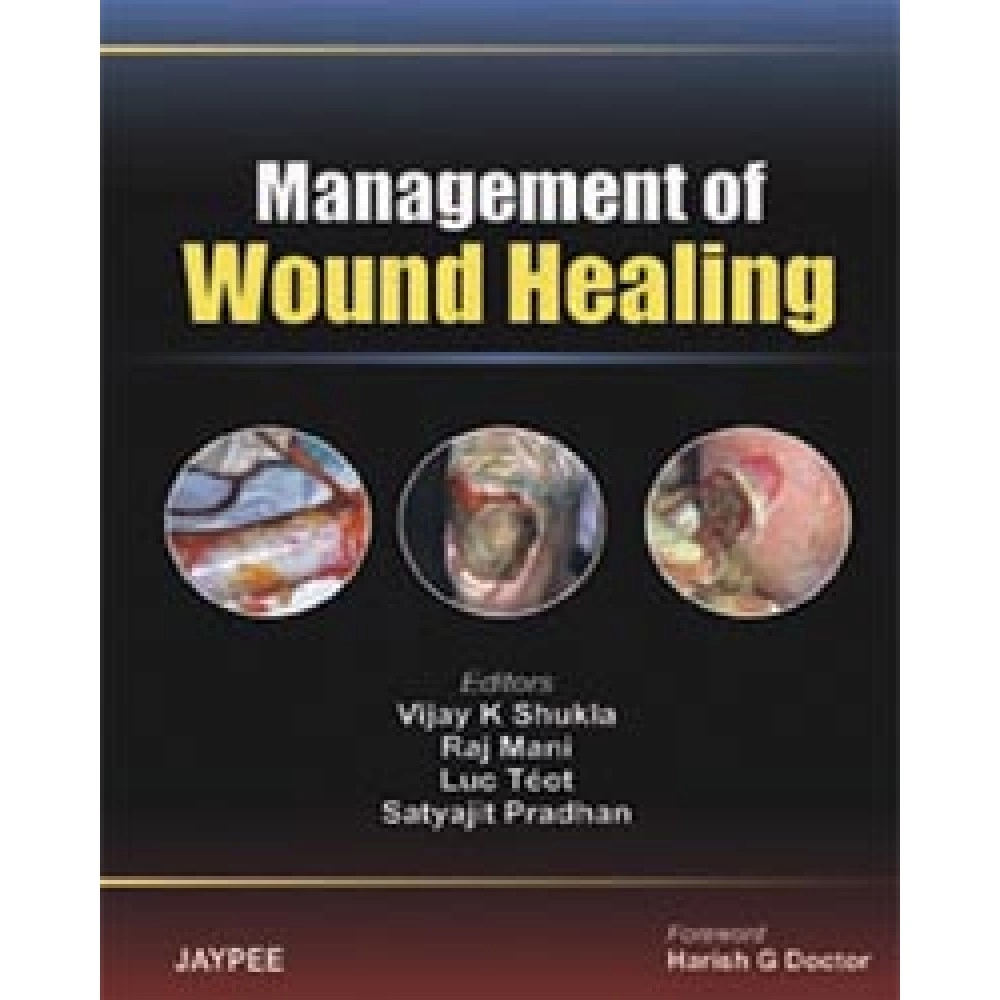 Management Of Wound Healing (E)