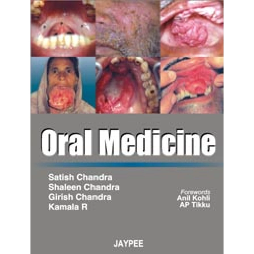 Oral Medicine By Satish Chandra