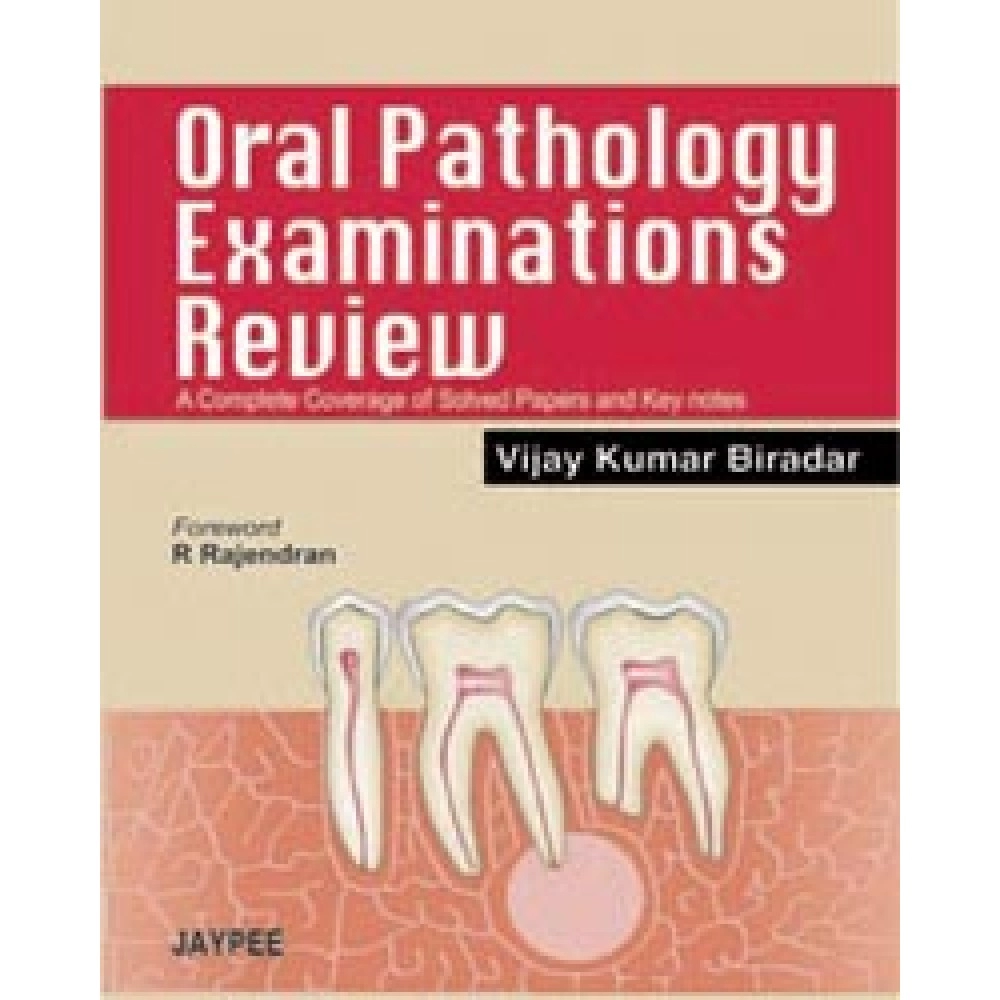 Oral Pathology Examinations Review A Complete Coverage Of Solved Papers And Key Notes