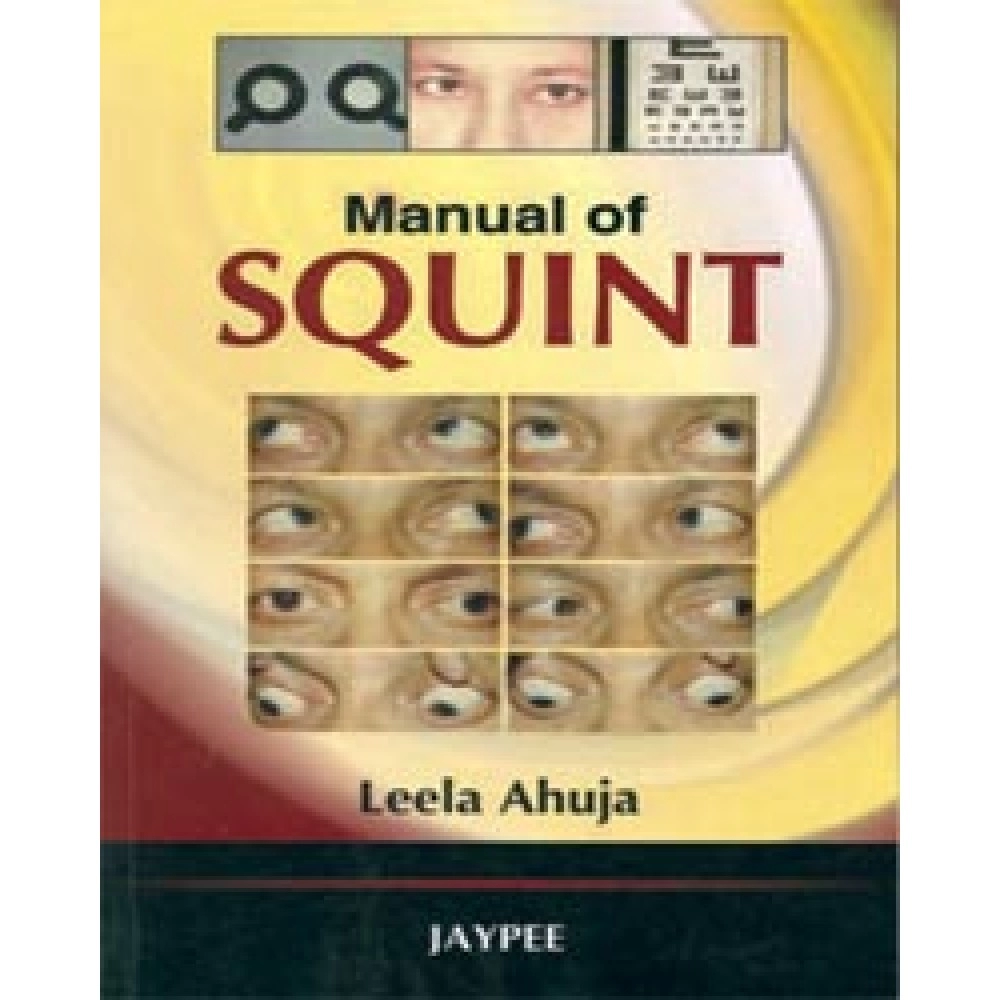 Manual of Squint By Leela Ahuja