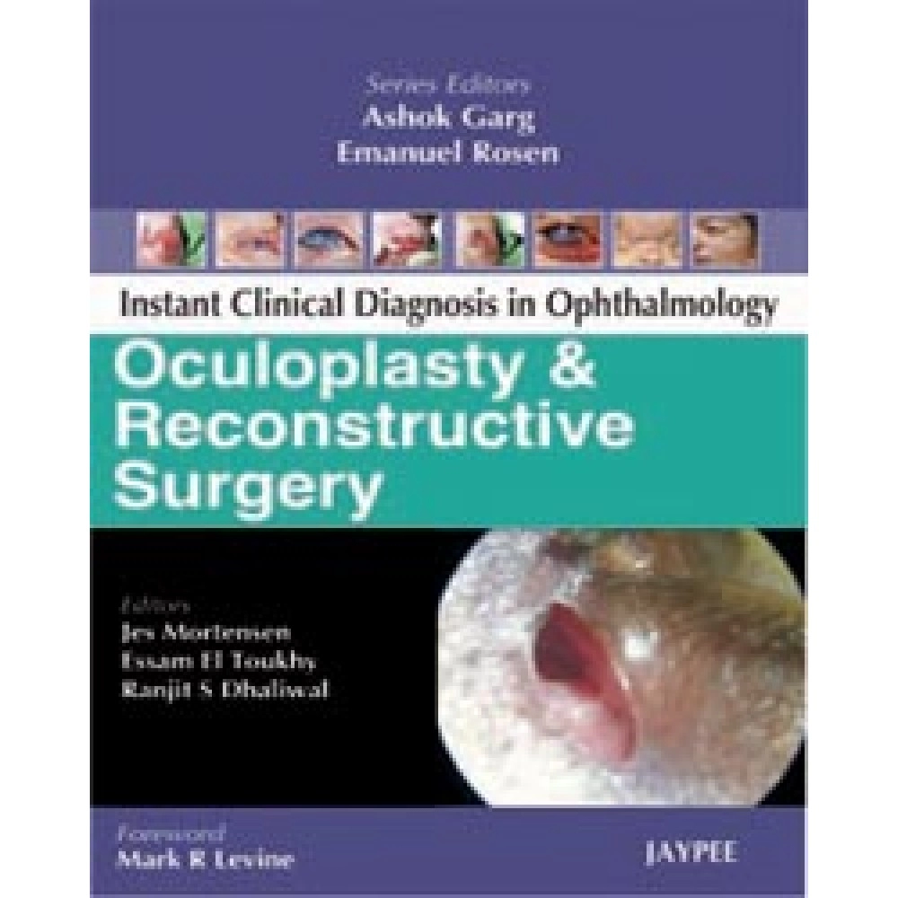 OCULOPLASTY & RECONSTRUCTIVE SURGERY INSTANT CLINICAL DIAGNOSIS IN OPHTHALMOLOGY