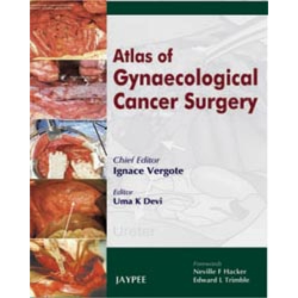 Atlas Of Gynaecological Cancer Surgery