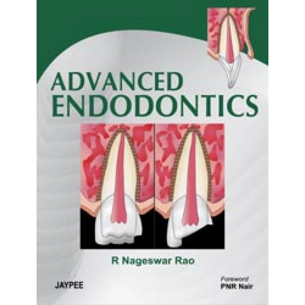 Advanced Endodontics