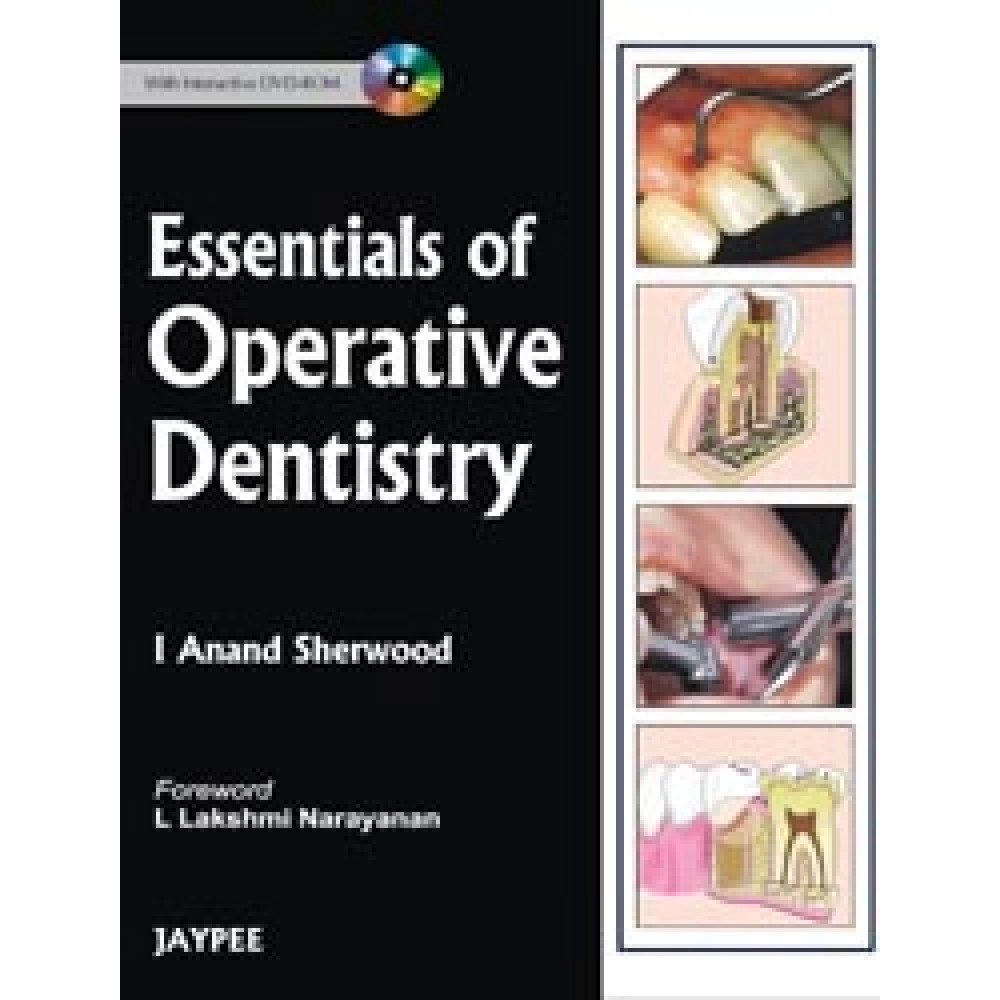 Essentials Of Operative Dentistry