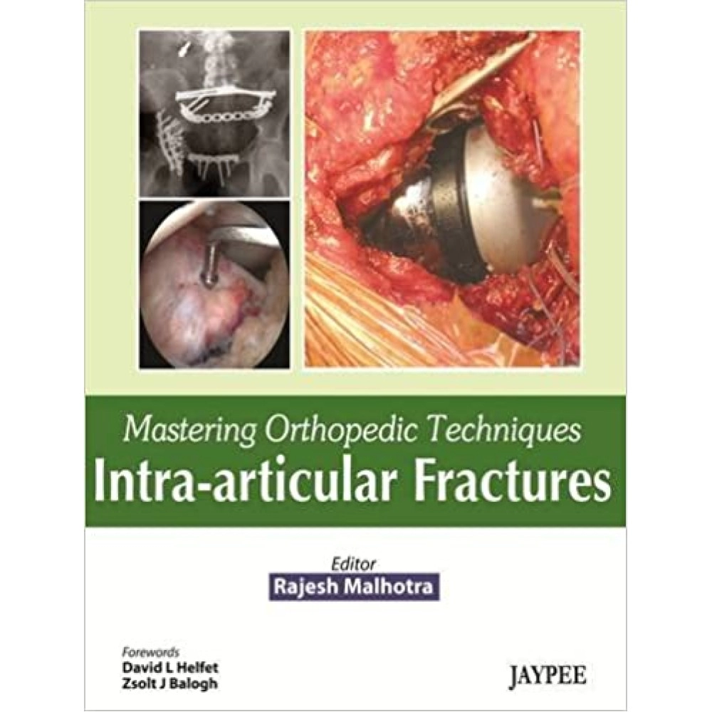 Mastering Orthopedic Techniques Intra-Arti