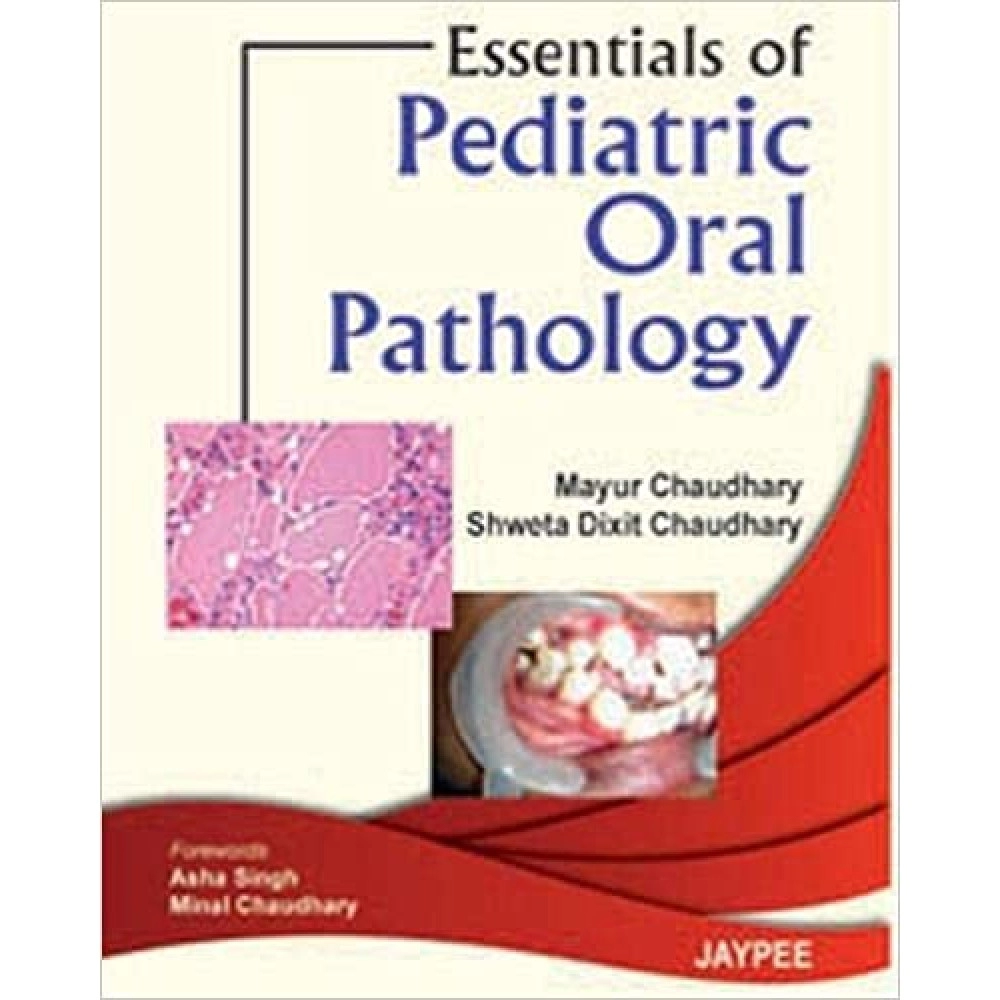 Essentials of Pediatric Oral Pathology