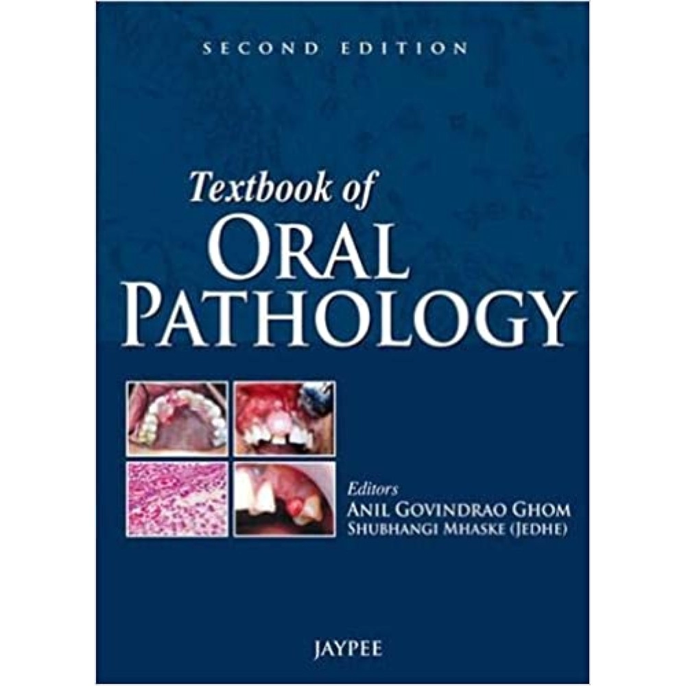 Textbook Of Oral Pathology,