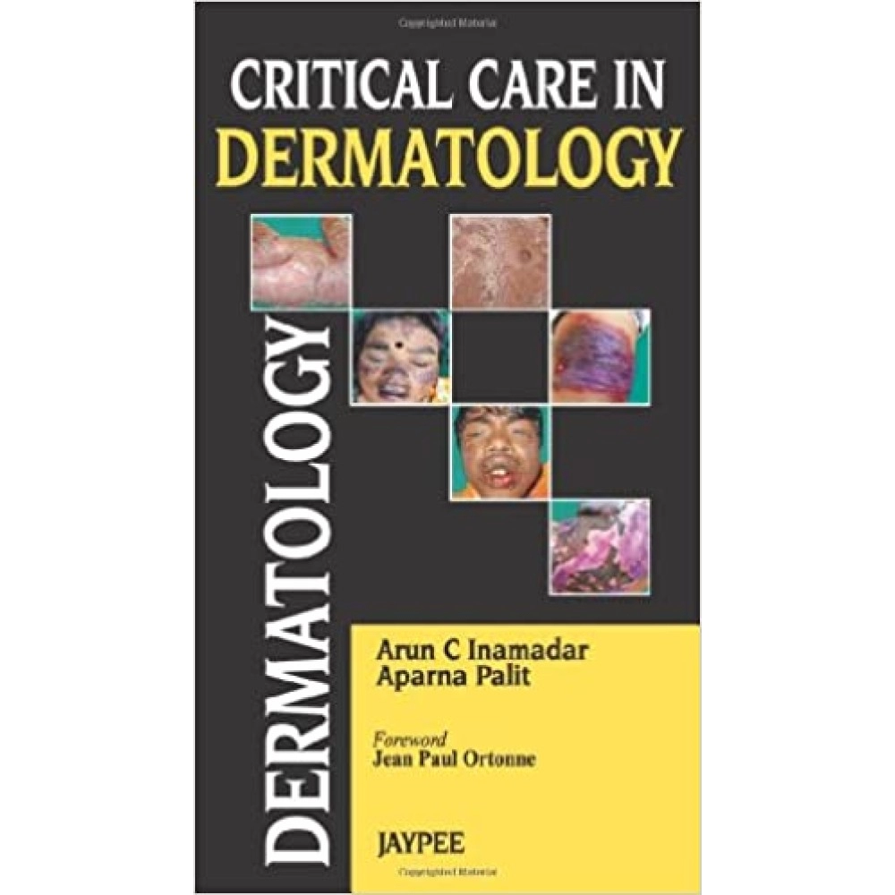 Critical Care in Dermatology