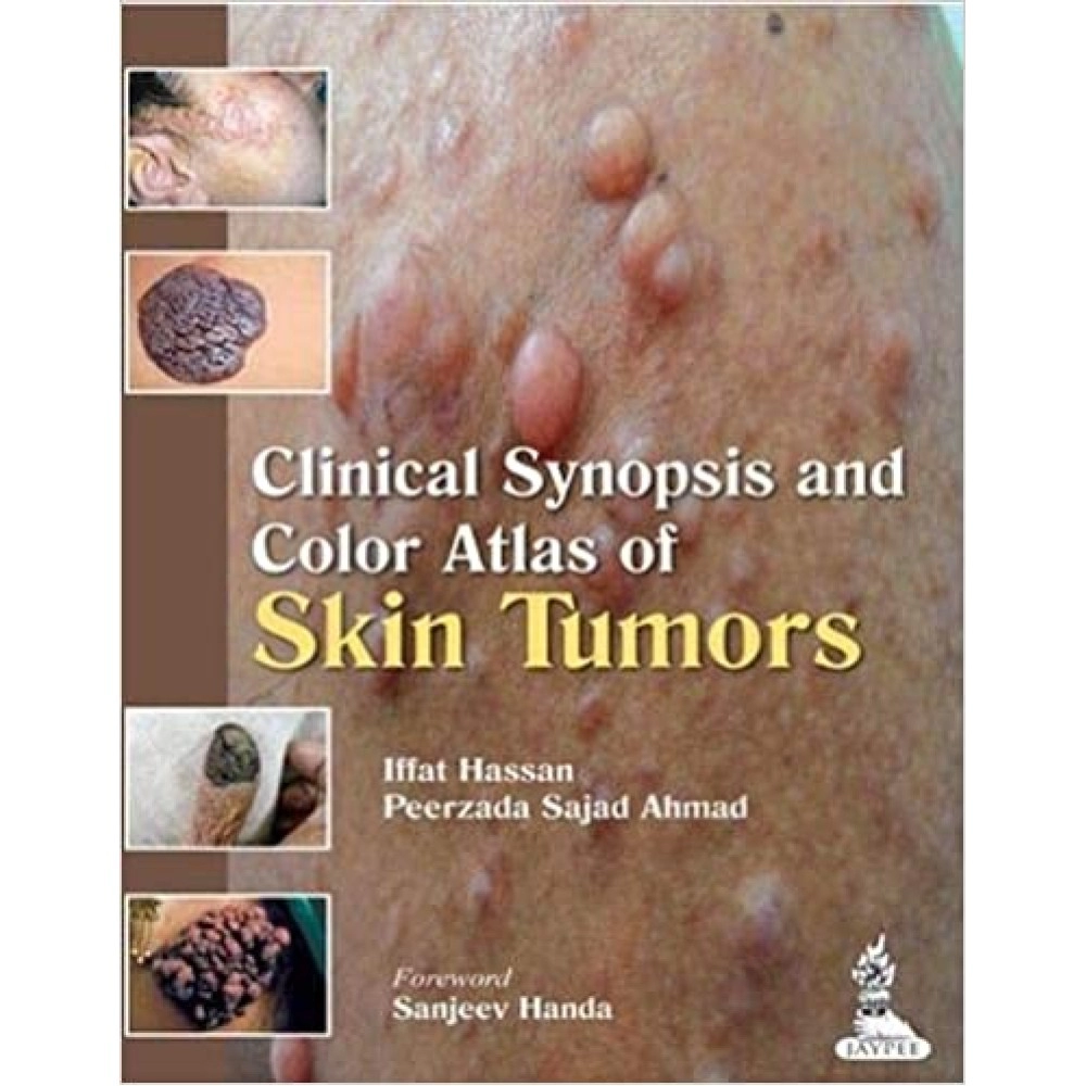 Clinical Synopsis and Color Atlas of Skin Tumors