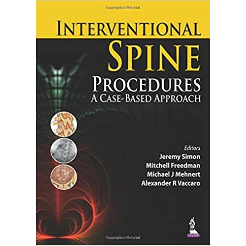 Interventional Spine Procedures: A Case-Based Approach