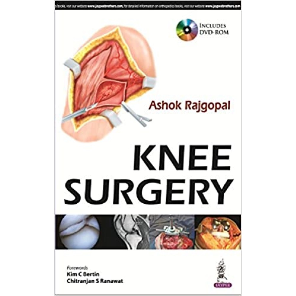 Knee Surgery By  Ashok Rajgopal