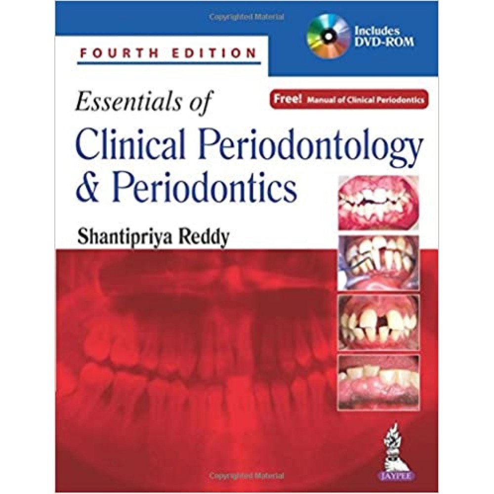 Essentials of Clinical Periodontology and Periodontics