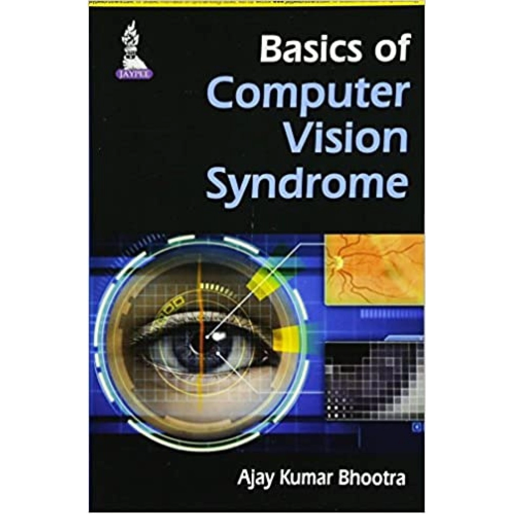 Basics Of Computer Vision Syndrome