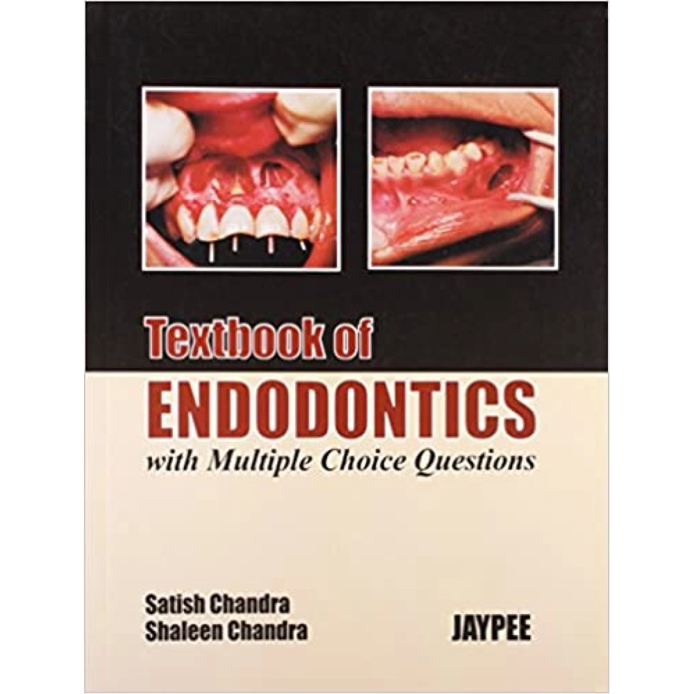 Textbook of Endodontics