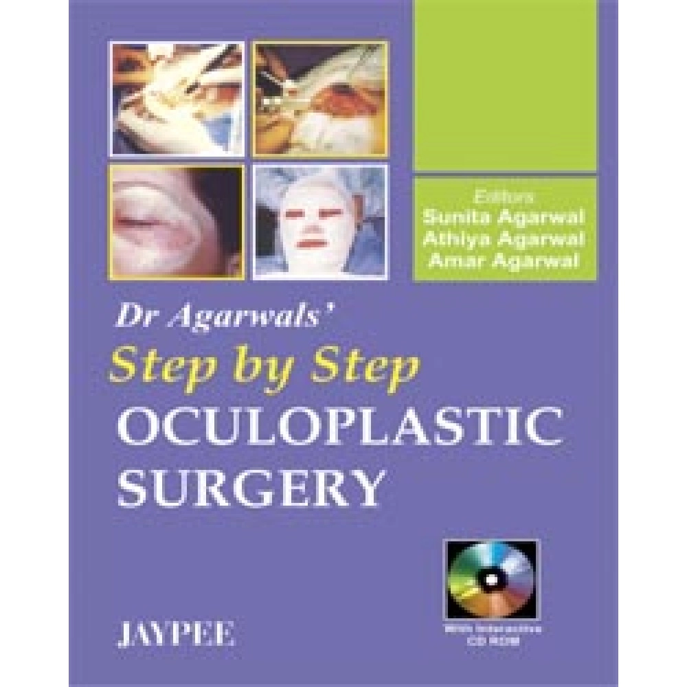 Step By Step Oculoplastic Surgery