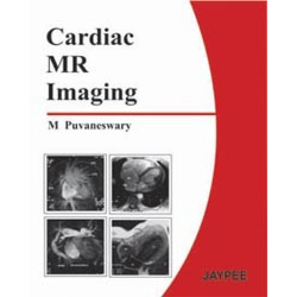 Cardiac Mr Imaging