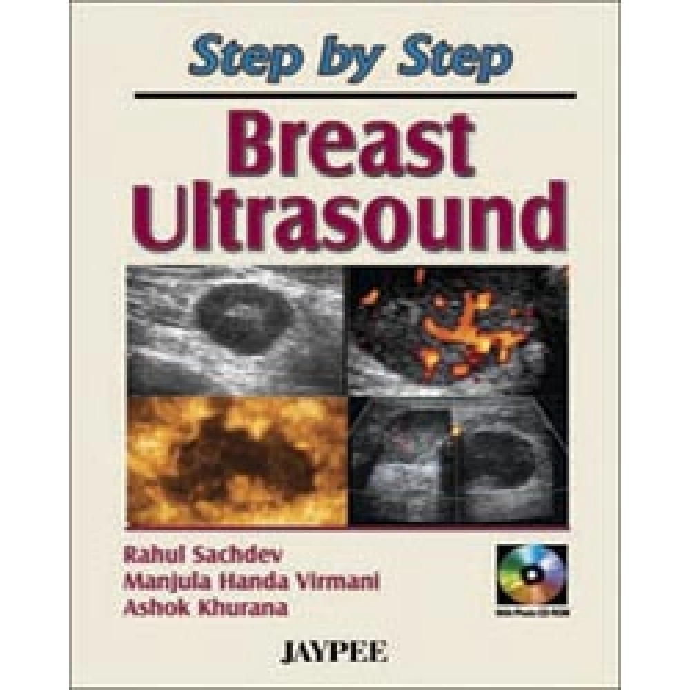 Step by Step: Breast Ultrasound with Photo CD-ROM