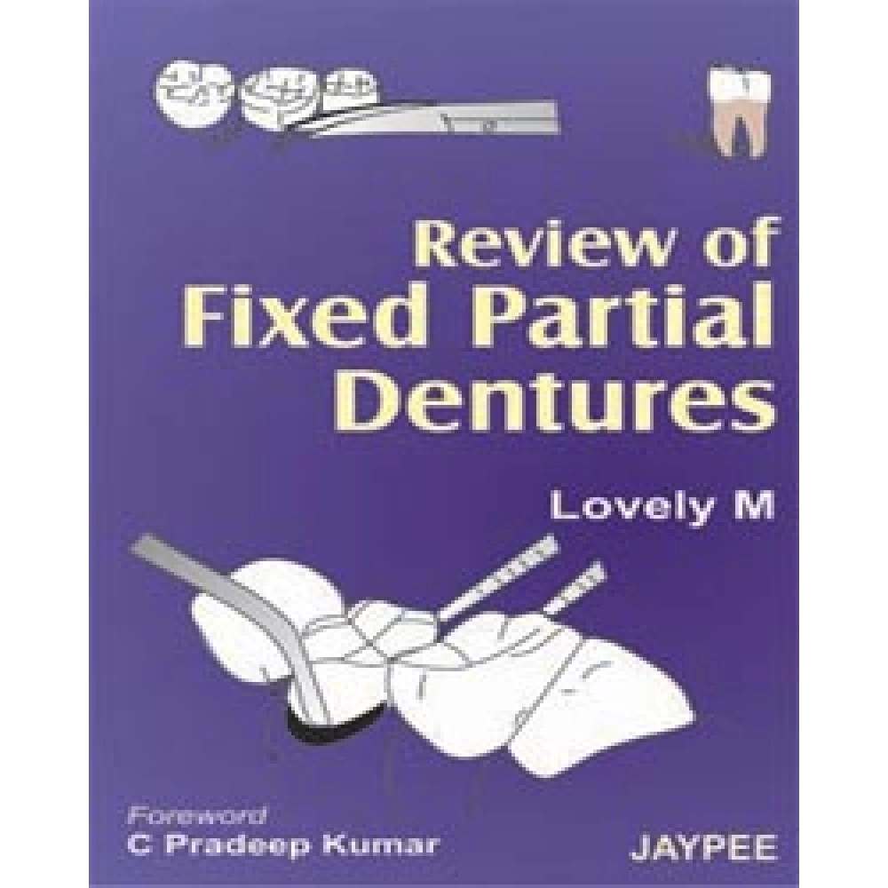 Review Of Fixed Partial Dentures