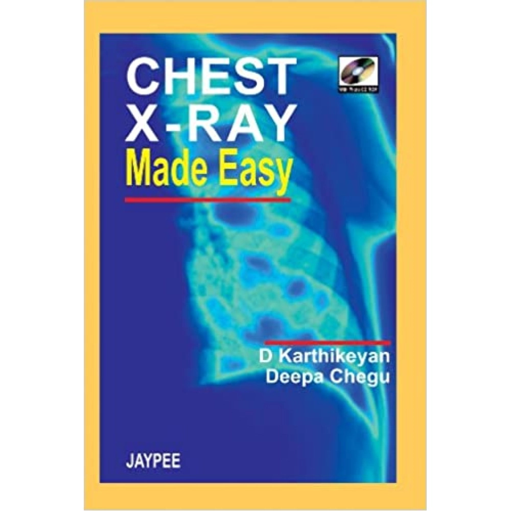 Chest X-Ray Made Easy - With Photo Cd-Rom 