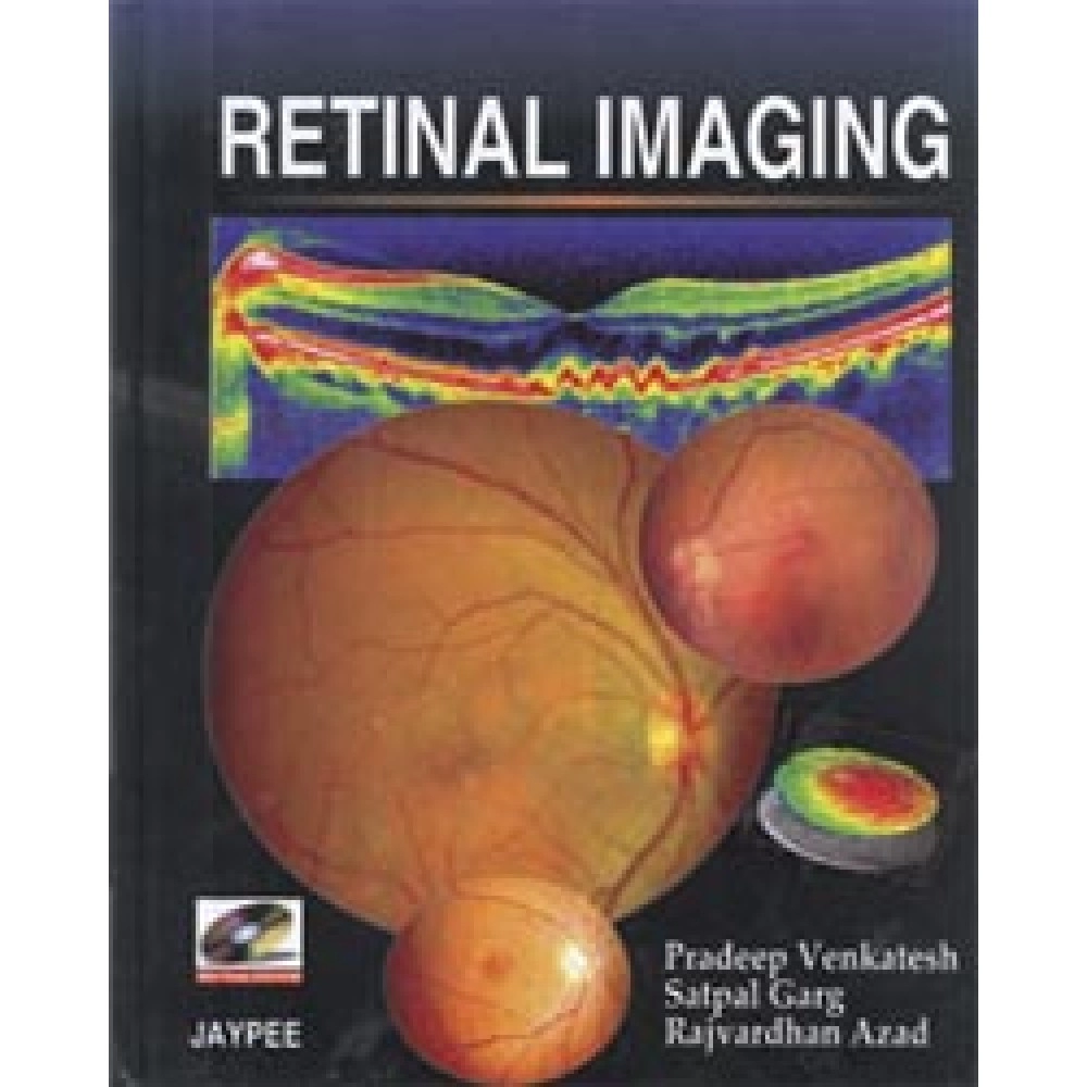Retinal Imaging (with Photo DVD-ROM)