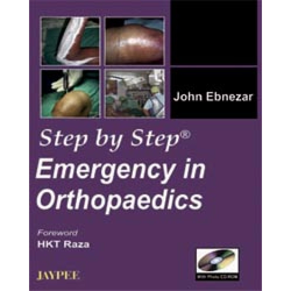 Step By Step Emergency In Orthopedics