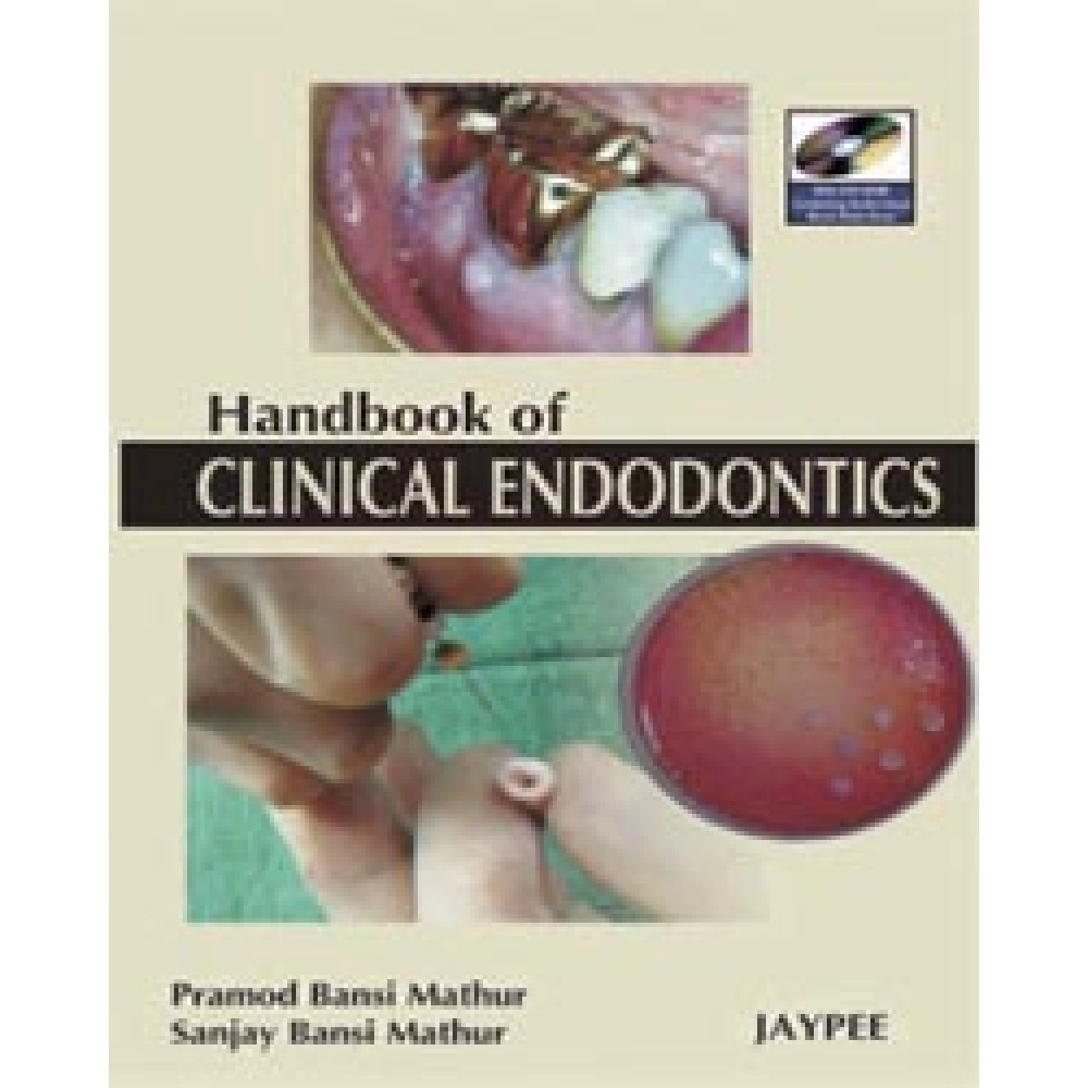 Handbook Of Clinical Endodontics With Dvd