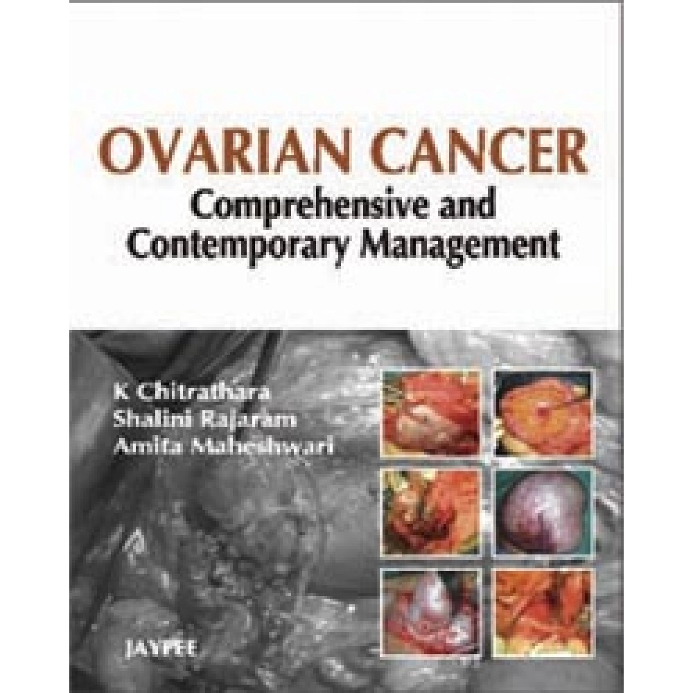 Ovarian Cancer: Comprehensive and Contemporary Management
