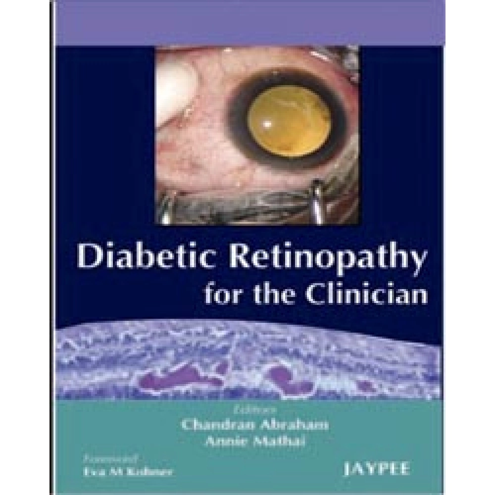 Diabetic Retinopathy For The Clinician