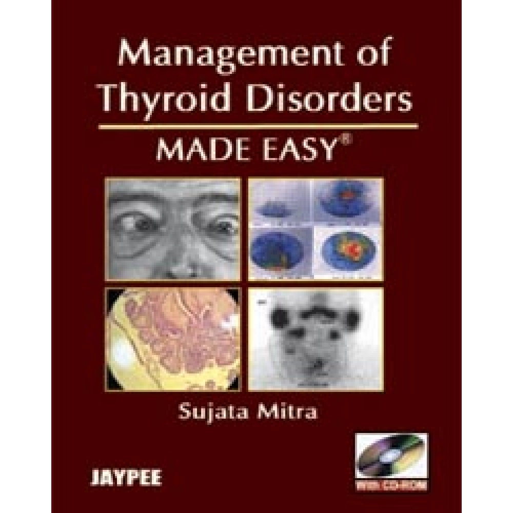 Management Of Thyroid Disorders Made Easy