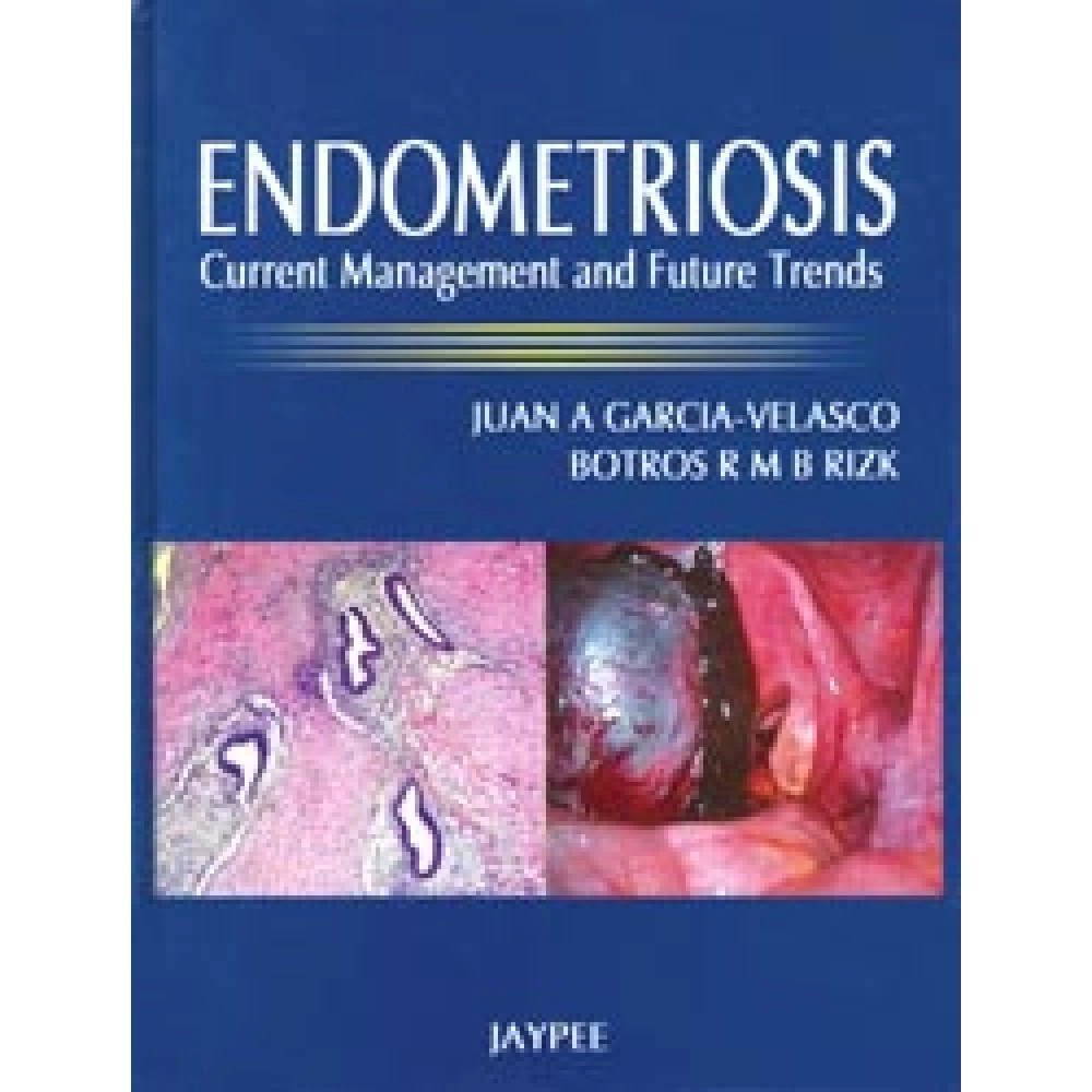 Endometriosis: Current Management and Future Trends
