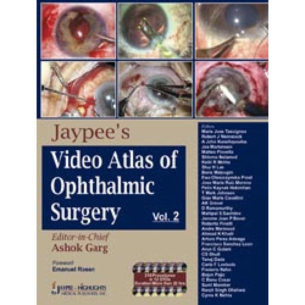 Jaypee's Video Atlas of Ophthalmic Surgery - Vol-2