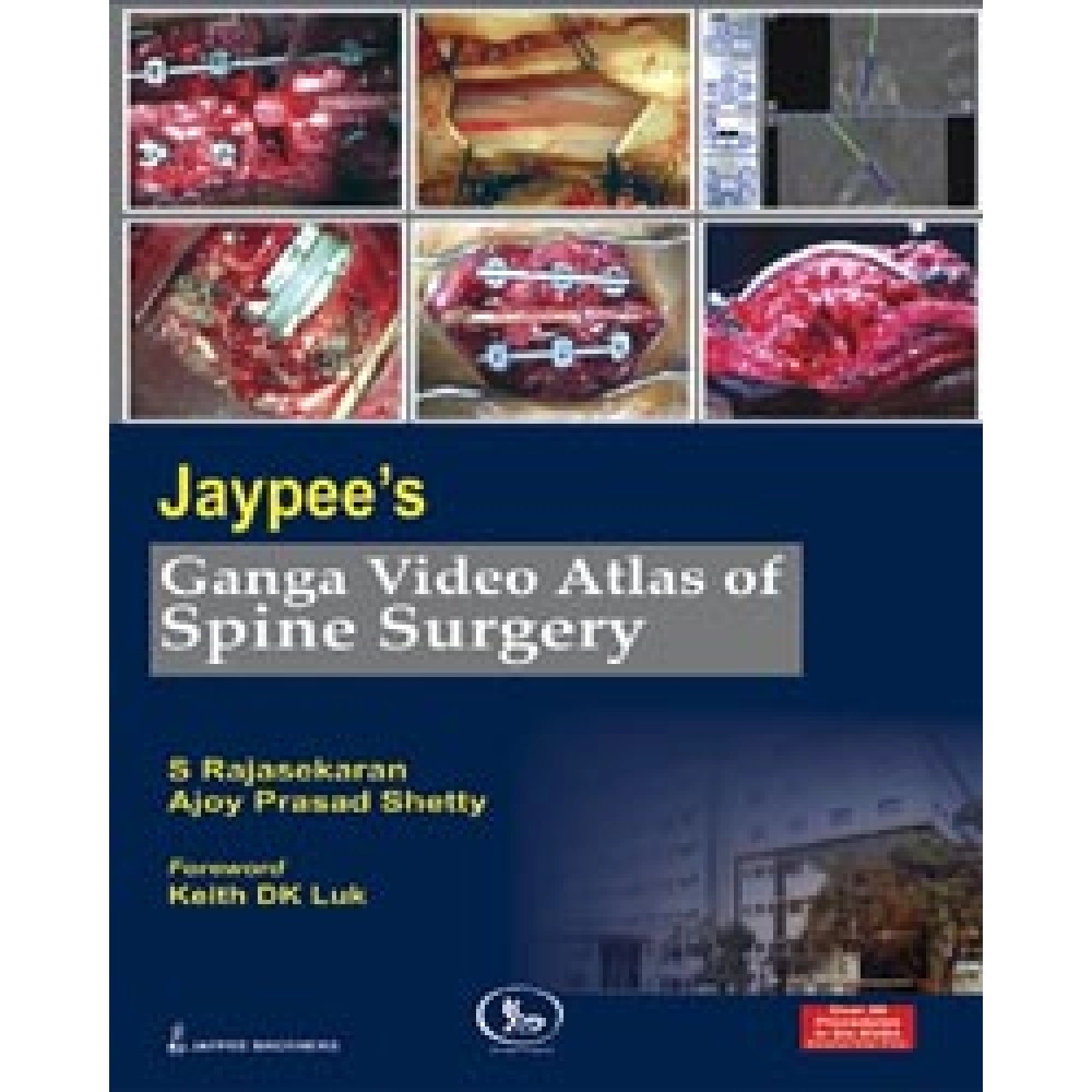Jaypee'S Ganga Video Atlas Of Spine Surgery